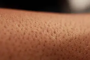 La repousse des poils des bras après une épilation à la cire et l’épilation à la lumière pulsée